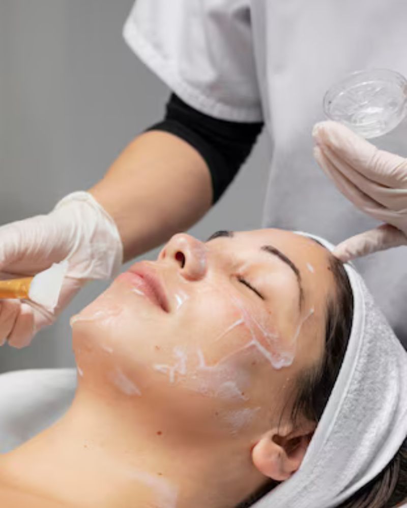 Chemical Peels Treatment