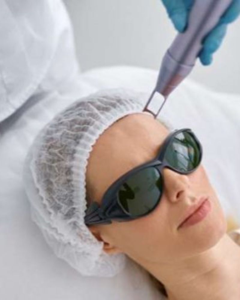 Laser Toning Treatment