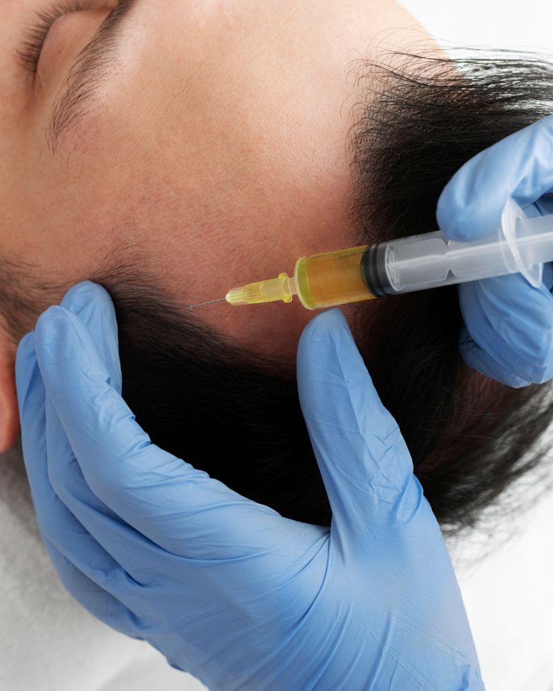 PRP Treatment