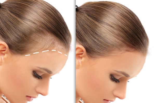 Booster Injections before and after