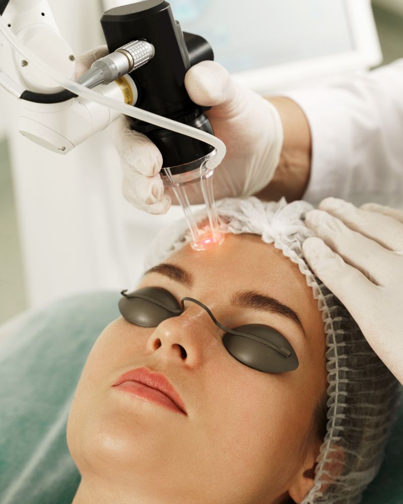 CO2 Laser Treatment