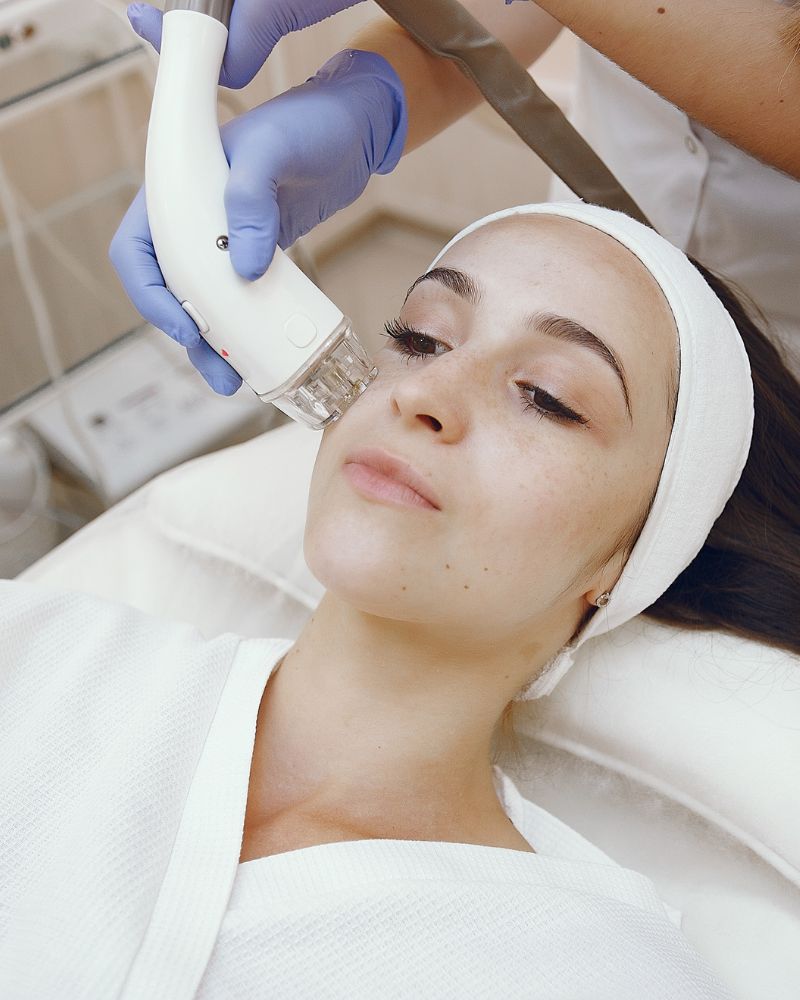 MNRF treatment